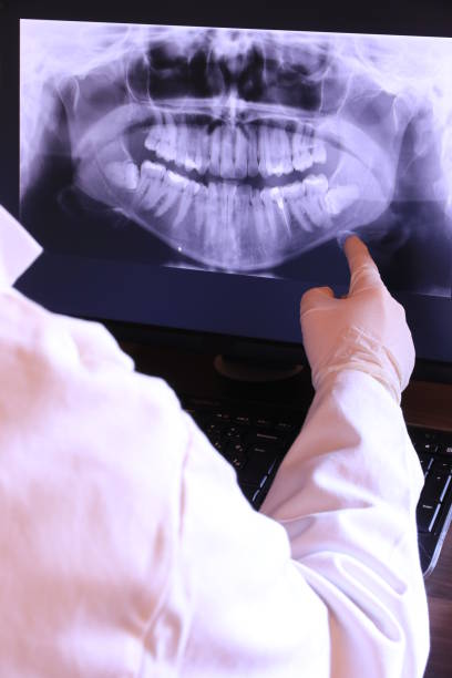 Best Chipped Tooth Repair Near Me  in Wixom, MI