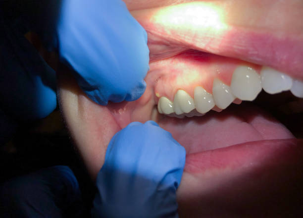 Best Knocked-Out Tooth Emergency  in Wixom, MI